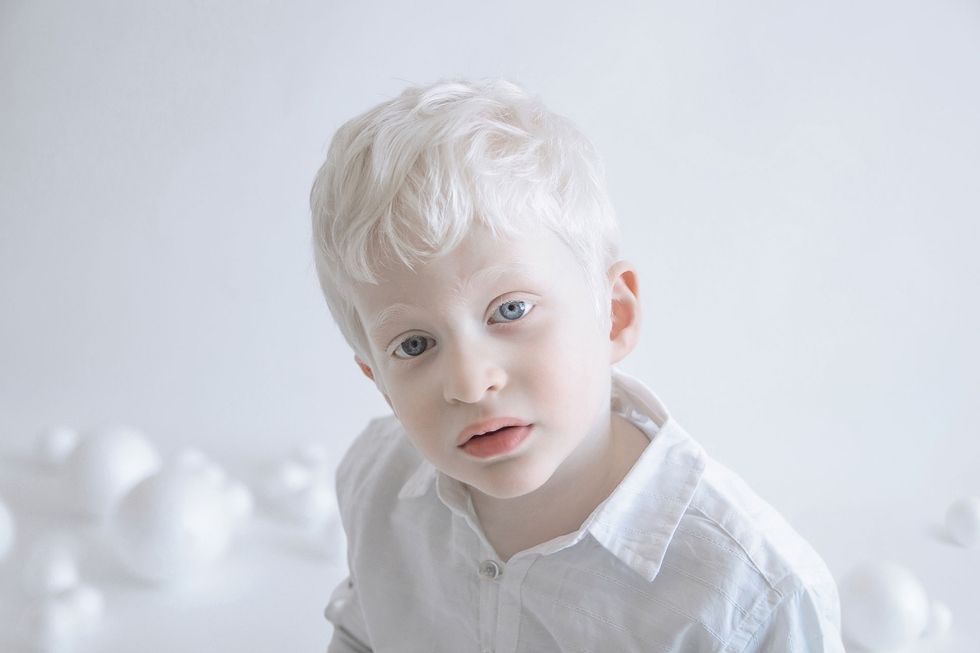 these-13-photos-perfectly-capture-the-beauty-of-people-with-albinism